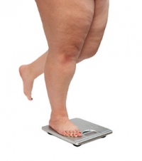 How Increased Weight May Affect the Feet