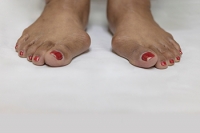 Reasons Why Bunions May Develop