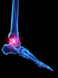 Possible Link between Rheumatoid Arthritis and Wheat Products